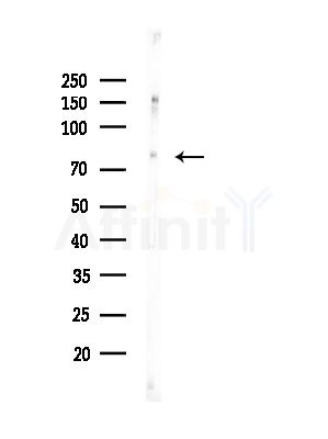 Phospho-SP1 (Thr739) Antibody - Western blot analysis of lysates from K562 cells(heat-shock,45min treatment), using Phospho-SP1 (Thr739) Antibody at 1/1000 dilution.