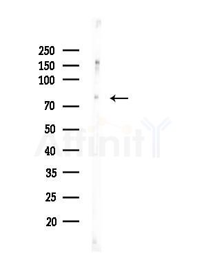 Phospho-SP1 (Thr739) Antibody - Western blot analysis of lysates from K562 cells(heat-shock,45min treatment), using Phospho-SP1 (Thr739) Antibody at 1/1000 dilution.