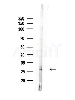 Phospho-Bcl-2 (Thr69) Antibody - Western blot analysis of lysates from LoVo cells(heat-shock, 45min treatment), using Phospho-Bcl-2 (Thr69) Antibody at 1/1000 dilution.