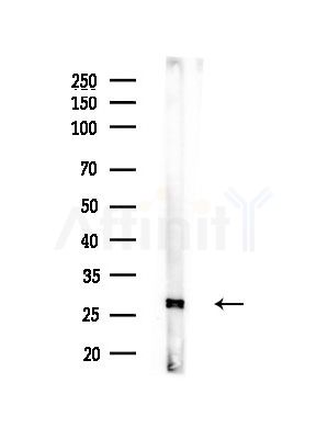 Phospho-Bcl-2 (Thr69) Antibody - Western blot analysis of lysates from Mouse brain, using Phospho-Bcl-2 (Thr69) Antibody at 1/1000 dilution.