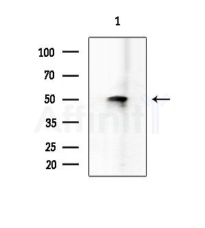 Phospho-Tau (Ser356)[Ser673] Antibody - Western blot analysis of extracts from Mouse brain, using Phospho-Tau (Ser356)[Ser673] Antibody at 1/1000 dilution.