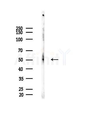 Phospho-Tau (Ser356)[Ser673] Antibody - Western blot analysis of lysates from Mouse brain, using Phospho-Tau (Ser356)[Ser673] Antibody at 1/1000 dilution.