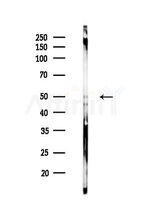 Phospho-Tau (Ser404)[Ser721] Antibody - Western blot analysis of lysates from EC304 cells(heat-shock treatment), using Phospho-Tau (Ser404)[Ser721] Antibody at 1/1000 dilution.