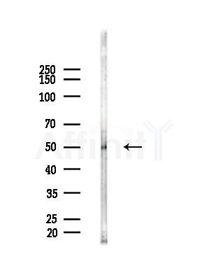 Phospho-Tau (Ser422)[Ser739] Antibody - Western blot analysis of lysates from Mouse brain, using Phospho-Tau (Ser422)[Ser739] Antibody at 1/1000 dilution.