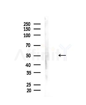Phospho-Tau (Thr212)[Thr529] Antibody - Western blot analysis of lysates from A375 cells(heat-shock,45min treatment), using Phospho-Tau (Thr212)[Thr529] Antibody at 1/1000 dilution.