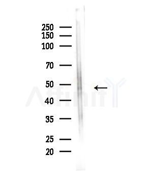 Phospho-Tau (Thr212)[Thr529] Antibody - Western blot analysis of lysates from Hela cells(UV,30min treatment), using Phospho-Tau (Thr212)[Thr529] Antibody at 1/1000 dilution.