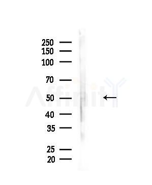 Phospho-Tau (Thr212)[Thr529] Antibody - Western blot analysis of lysates from A375 cells(heat-shock,45min treatment), using Phospho-Tau (Thr212)[Thr529] Antibody at 1/1000 dilution.
