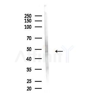 Phospho-Tau (Thr212)[Thr529] Antibody - Western blot analysis of lysates from Hela cells(UV,30min treatment), using Phospho-Tau (Thr212)[Thr529] Antibody at 1/1000 dilution.