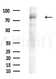Phospho-Tau (Thr181)[Thr498] Antibody - Western blot analysis of extracts from A375 cells(heat-shock,45min treatment), using Phospho-Tau (Thr181)[Thr498] Antibody at 1/1000 dilution.