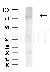 Phospho-Tau (Thr181)[Thr498] Antibody - Western blot analysis of extracts from Rat liver, using Phospho-Tau (Thr181)[Thr498] Antibody at 1/1000 dilution.