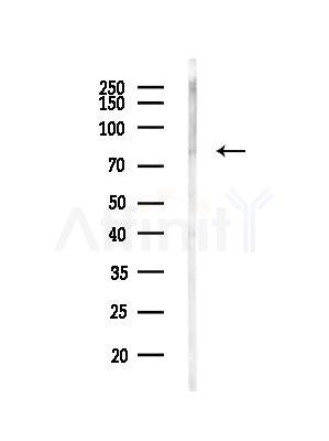 Phospho-Tau (Thr181)[Thr498] Antibody - Western blot analysis of lysates from Rat liver, using Phospho-Tau (Thr181)[Thr498] Antibody at 1/1000 dilution.