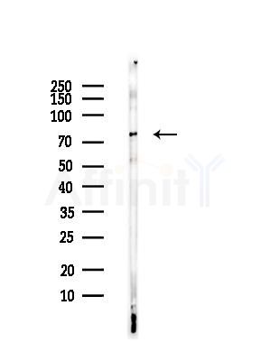 Phospho-Tau (Thr205)[Thr522] Antibody - Western blot analysis of lysates from HUVEC cells, using Phospho-Tau (Thr205)[Thr522] Antibody at 1/1000 dilution.
