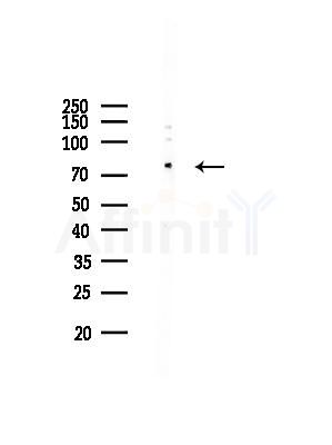Phospho-Tau (Thr205)[Thr522] Antibody - Western blot analysis of lysates from COLO205 cells, using Phospho-Tau (Thr205)[Thr522] Antibody at 1/1000 dilution.