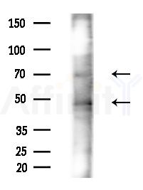 Phospho-Tau (Ser262)[Ser579] Antibody - Western blot analysis of extracts from MCF7 cells(heat-shock,45min treatment), using Phospho-Tau (Ser262)[Ser579] Antibody at 1/1000 dilution.