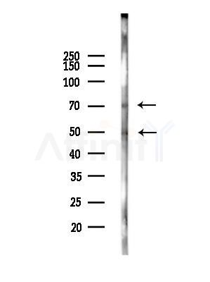 Phospho-Tau (Ser262)[Ser579] Antibody - Western blot analysis of lysates from MCF7 cells(heat-shock,45min treatment), using Phospho-Tau (Ser262)[Ser579] Antibody at 1/1000 dilution.