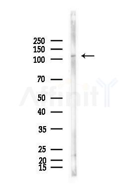Phospho-FGFR1 (Tyr766) Antibody - Western blot analysis of lysates from Raji cells(heat-shock,45min treatment), using Phospho-FGFR1 (Tyr766) Antibody at 1/1000 dilution.