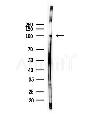 Phospho-FGFR1 (Tyr154) Antibody - Western blot analysis of lysates from COLO205 cells(heat-shock,45min treatment), using Phospho-FGFR1 (Tyr154) Antibody at 1/1000 dilution.