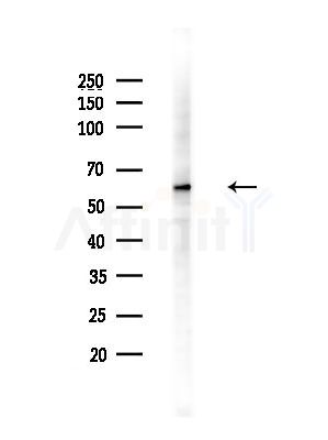 Phospho-Src (Tyr527)[Tyr530] Antibody - Western blot analysis of lysates from Hela cells(heat-shock,45min treatment), using Phospho-Src (Tyr527)[Tyr530] Antibody at 1/1000 dilution.