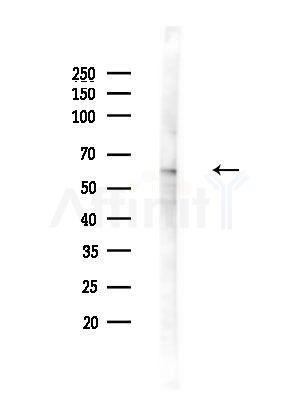 Phospho-Src (Tyr527)[Tyr530] Antibody - Western blot analysis of lysates from Rat testis, using Phospho-Src (Tyr527)[Tyr530] Antibody at 1/1000 dilution.