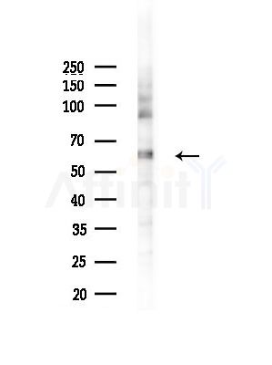 Phospho-Src (Tyr527)[Tyr530] Antibody - Western blot analysis of lysates from LoVo cells(heat-shock, 45min treatment), using Phospho-Src (Tyr527)[Tyr530] Antibody at 1/1000 dilution.