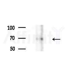 Phospho-Cyclin B1 (Ser126) Antibody - Western blot analysis of extracts from A375 cells(heat-shock,45min treatment), using Phospho-Cyclin B1 (Ser126) Antibody at 1/1000 dilution.