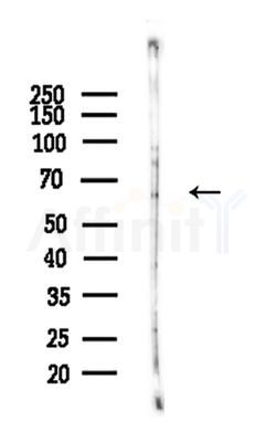 Phospho-Cyclin B1 (Ser126) Antibody - Western blot analysis of lysates from A375 cells(heat-shock,45min treatment), using Phospho-Cyclin B1 (Ser126) Antibody at 1/1000 dilution.