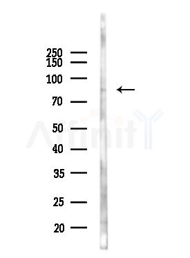 Phospho-B Raf (Thr599) Antibody - Western blot analysis of lysates from EC304 cells(heat-shock,45min treatment), using Phospho-B Raf (Thr599) Antibody at 1/1000 dilution.