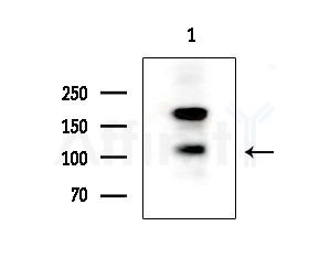 Phospho-B Raf (Ser446) Antibody - Western blot analysis of extracts from K562 cells, using Phospho-B Raf (Ser446) Antibody at 1/1000 dilution.