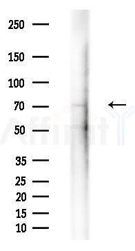 Phospho-Ezrin (Tyr146) Antibody - Western blot analysis of extracts from Mouse liver, using Phospho-Ezrin (Tyr146) Antibody at 1/1000 dilution.