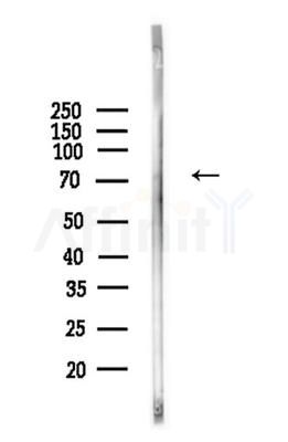 Phospho-Ezrin (Tyr146) Antibody - Western blot analysis of lysates from Mouse liver, using Phospho-Ezrin (Tyr146) Antibody at 1/1000 dilution.