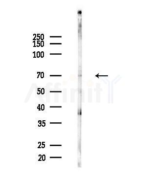 Phospho-ATF2 (Thr69/Thr51) Antibody - Western blot analysis of lysates from B16F10-LUC cells(UV,30min treatment), using Phospho-ATF2 (Thr69/Thr51) Antibody at 1/1000 dilution.