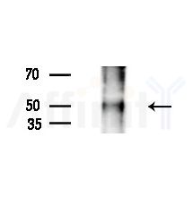 Phospho-ATF2 (Thr73/Thr55) Antibody - Western blot analysis of extracts from A375 cells(heat-shock,45min treatment), using Phospho-ATF2 (Thr73/Thr55) Antibody at 1/1000 dilution.