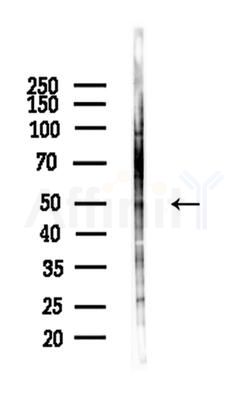 Phospho-ATF2 (Thr73/Thr55) Antibody - Western blot analysis of lysates from A375 cells(heat-shock,45min treatment), using Phospho-ATF2 (Thr73/Thr55) Antibody at 1/1000 dilution.
