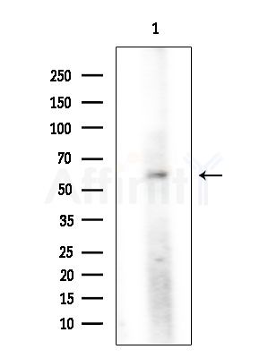 Phospho-CD19 (Tyr531) Antibody - Western blot analysis of extracts from EC304 cells, using Phospho-CD19 (Tyr531) Antibody at 1/1000 dilution.