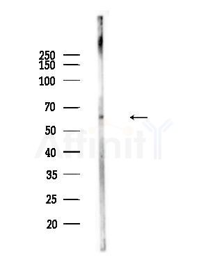 Phospho-CD19 (Tyr531) Antibody - Western blot analysis of lysates from EC304 cells, using Phospho-CD19 (Tyr531) Antibody at 1/1000 dilution.