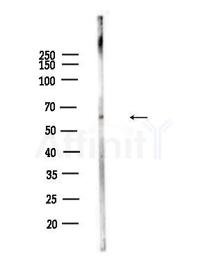 Phospho-CD19 (Tyr531) Antibody - Western blot analysis of lysates from EC304 cells, using Phospho-CD19 (Tyr531) Antibody at 1/1000 dilution.