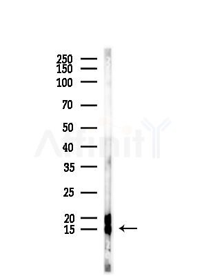 Phospho-Histone H2A.X (Ser139)[Ser140] Antibody - Western blot analysis of lysates from COS-7 cells(heat-shock,45min treatment), using Phospho-Histone H2A.
