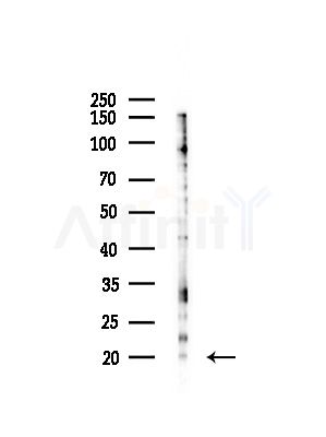 Phospho-Stathmin 1 (Ser16) Antibody - Western blot analysis of lysates from COLO205 cells(heat-shock,45min treatment), using Phospho-Stathmin 1 (Ser16) Antibody at 1/1000 dilution.