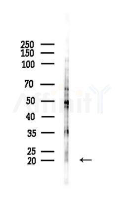 Phospho-Stathmin 1 (Ser38) Antibody - Western blot analysis of lysates from COLO205 cells(heat-shock,45min treatment), using Phospho-Stathmin 1 (Ser38) Antibody at 1/1000 dilution.