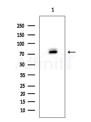 Phospho-Synapsin I (Ser9) Antibody - Western blot analysis of extracts from Mouse brain, using Phospho-Synapsin I (Ser9) Antibody at 1/1000 dilution.