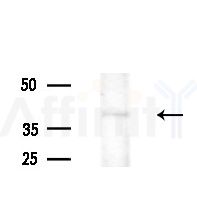 Phospho-CEBP Beta (Thr235/Thr188) Antibody - Western blot analysis of extracts from A375 cells(heat-shock,45min treatment), using Phospho-CEBP Beta (Thr235/Thr188) Antibody at 1/1000 dilution.