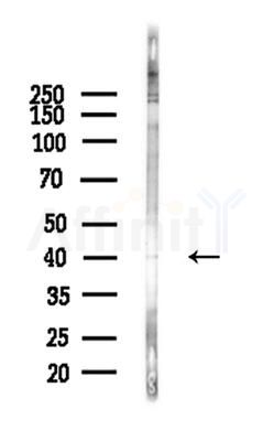 Phospho-CEBP Beta (Thr235/Thr188) Antibody - Western blot analysis of lysates from A375 cells(heat-shock,45min treatment), using Phospho-CEBP Beta (Thr235/Thr188) Antibody at 1/1000 dilution.