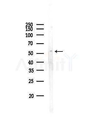 Phospho-GABA A Receptor beta 1 (Ser434) Antibody - Western blot analysis of lysates from COLO205 cells, using Phospho-GABA A Receptor beta 1 (Ser434) Antibody at 1/1000 dilution.