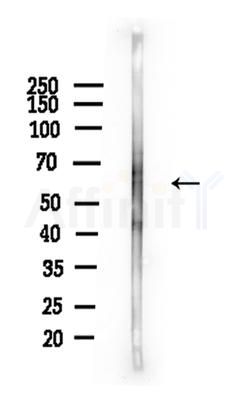 Phospho-ELK1 (Ser389) Antibody - Western blot analysis of lysates from A375 cells(heat-shock,45min treatment), using Phospho-ELK1 (Ser389) Antibody at 1/1000 dilution.