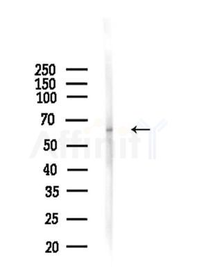 Phospho-ELK1 (Ser389) Antibody - Western blot analysis of lysates from Mouse liver, using Phospho-ELK1 (Ser389) Antibody at 1/1000 dilution.