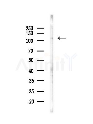 Phospho-NF kappaB p105/p50 (Ser927) Antibody - Western blot analysis of lysates from COLO205 cells(heat-shock,45min treatment), using Phospho-NF kappaB p105/p50 (Ser927) Antibody at 1/1000 dilution.