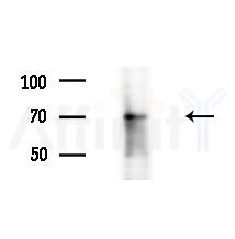 Phospho-Synaptotagmin 1/2 (Thr202) Antibody - Western blot analysis of extracts from EC304 cells
(heat-shock treatment), using Phospho-Synaptotagmin 1/2 (Thr202) Antibody at 1/1000 dilution.
