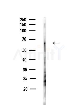 Phospho-Synaptotagmin 1/2 (Thr202) Antibody - Western blot analysis of lysates from EC304 cells(heat-shock treatment), using Phospho-Synaptotagmin 1/2 (Thr202) Antibody at 1/1000 dilution.