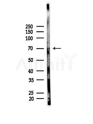 Phospho-p70 S6 Kinase (Thr229)[Thr252] Antibody - Western blot analysis of lysates from B16F10-LUC cells(LPS, 4h treatment), using Phospho-p70 S6 Kinase (Thr229)[Thr252] Antibody at 1/1000 dilution.