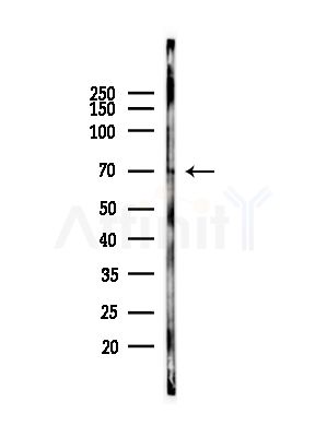 Phospho-p70 S6 Kinase (Thr229)[Thr252] Antibody - Western blot analysis of lysates from COS-7 cells(heat-shock,45min treatment), using Phospho-p70 S6 Kinase (Thr229)[Thr252] Antibody at 1/1000 dilution.